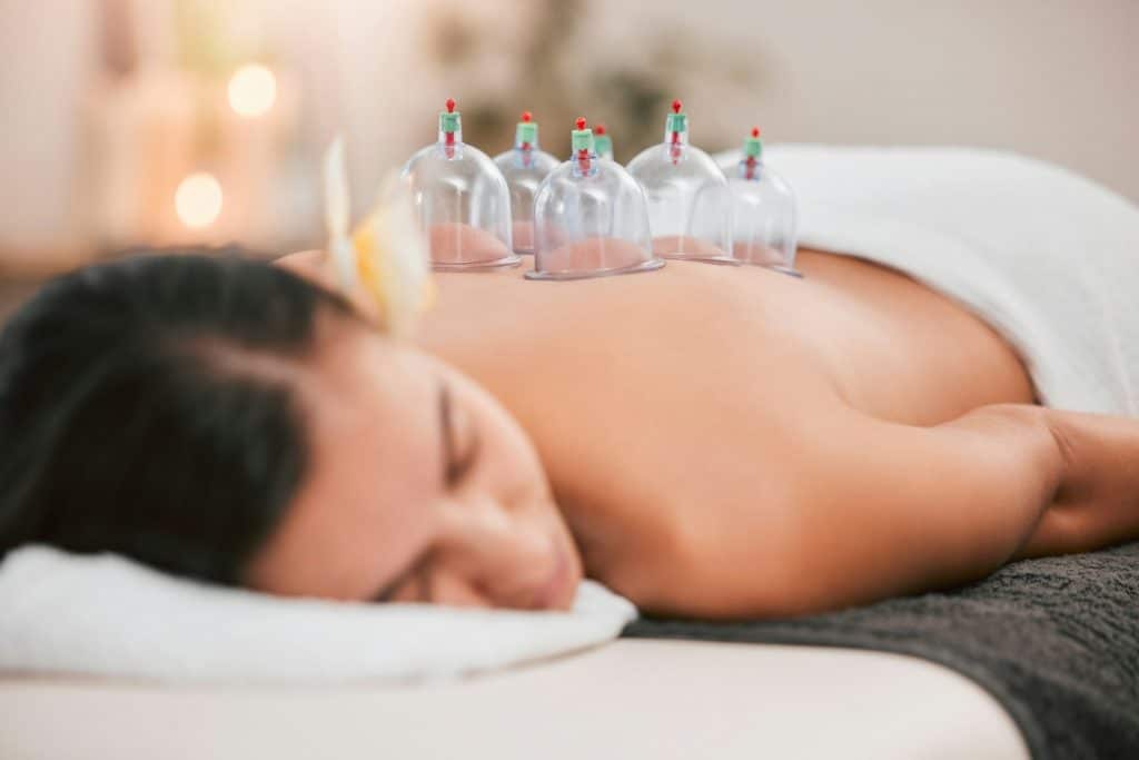 Spa in singapore, physiotherapy or cupping therapy woman for massage, back pain or luxury wellness